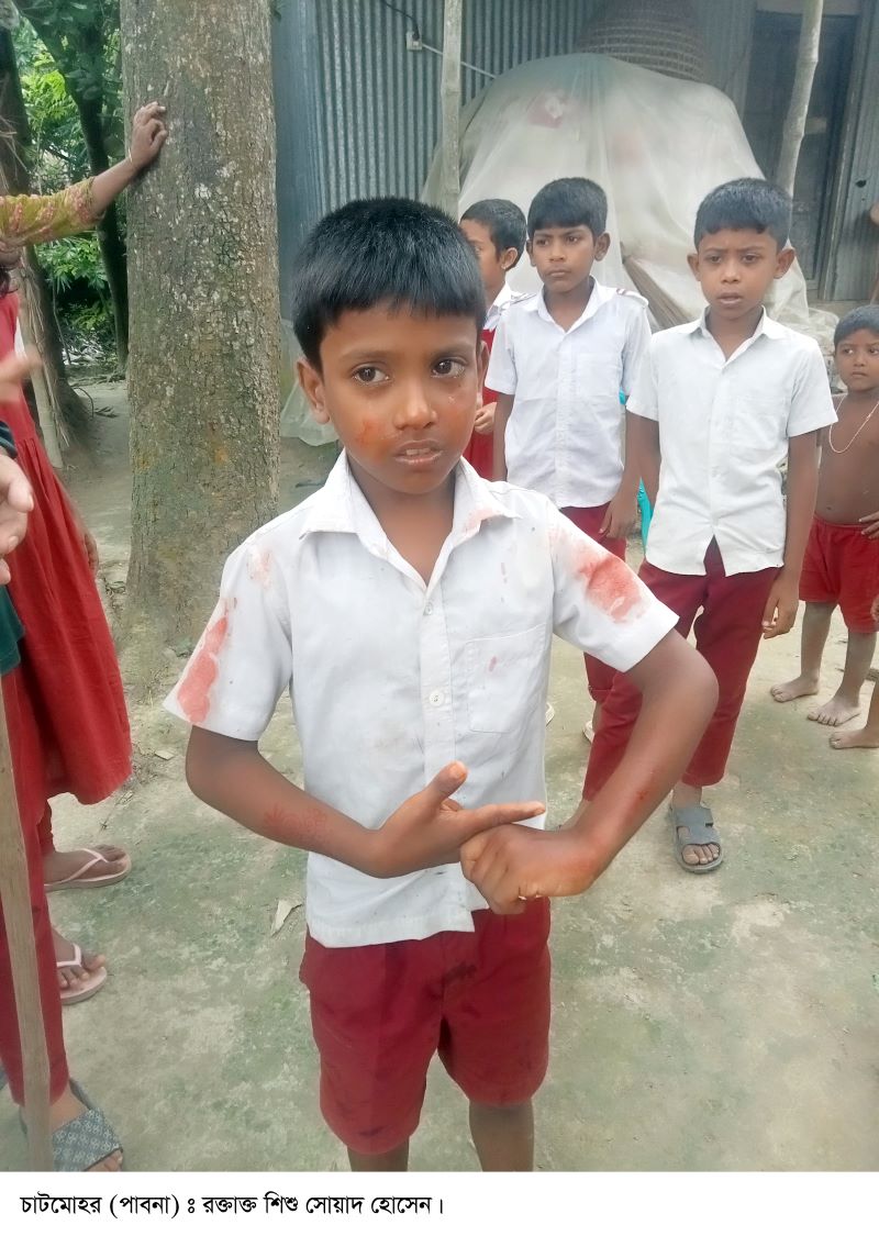 তুচ্ছ ঘটনায় দ্বিতীয় শ্রেণির শিক্ষার্থীর নাক ফাটালেন সহকারি শিক্ষক!